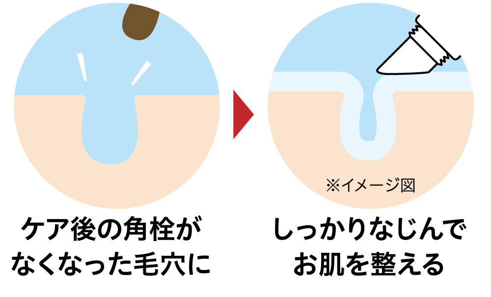 ノットオープンジェル:イメージ図