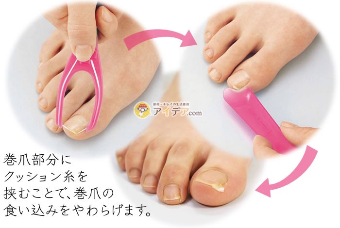 巻爪ガードクッション