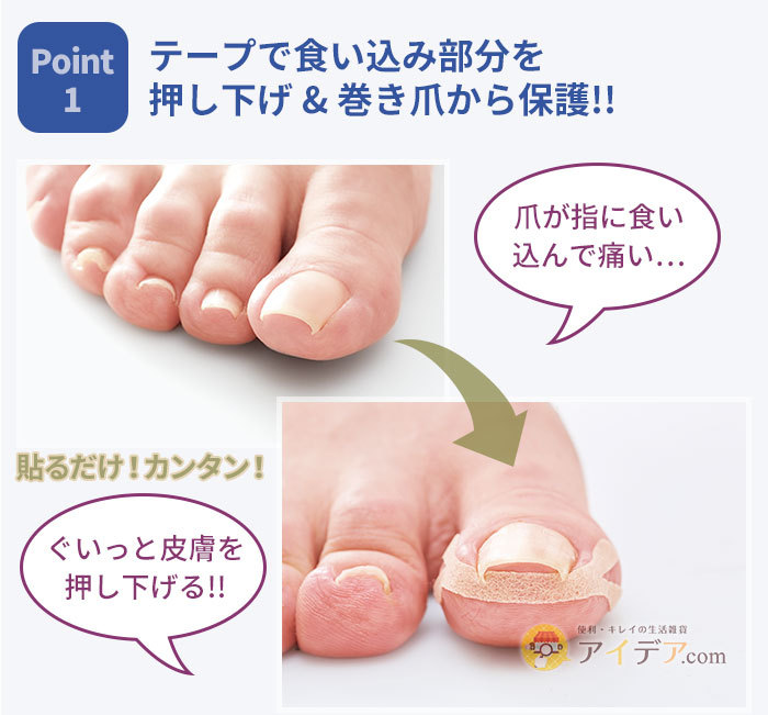 テープで食い込み部分を押し下げ & 巻き爪から保護!!