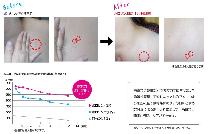 12月スーパーSALE ポロリンボEX 角質粒対策 18g×48個セット (4936201101405) 通販 新品未使用 ポロリンボEX 美容液ジェル 18g