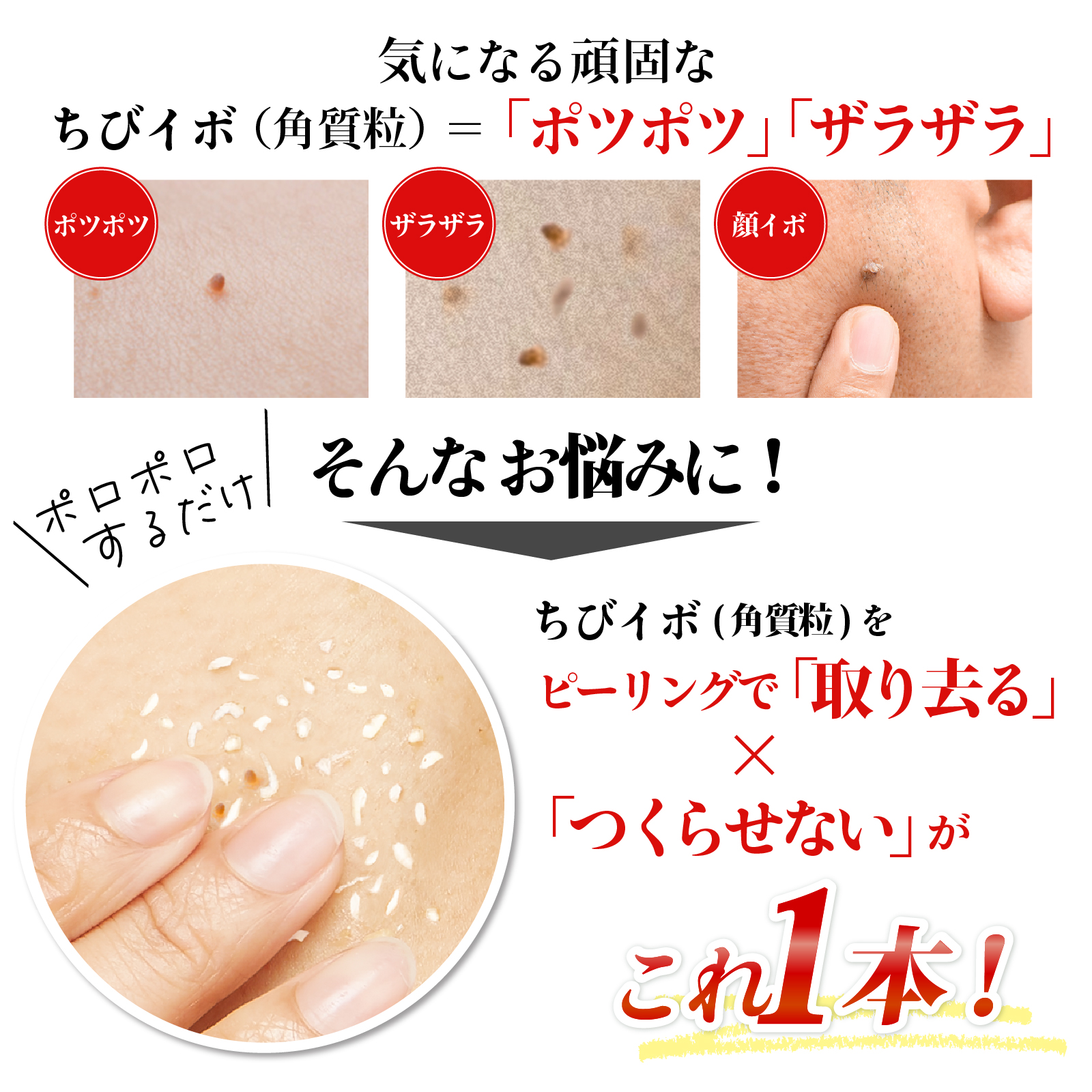 イボ取り ピーリング 首イボ 除去 ヨクイニン 薬用 クリーム ジェル ハトムギ 角質粒取り 首 首 顔 胸元 ピーリングスムーサーEXW 爆買