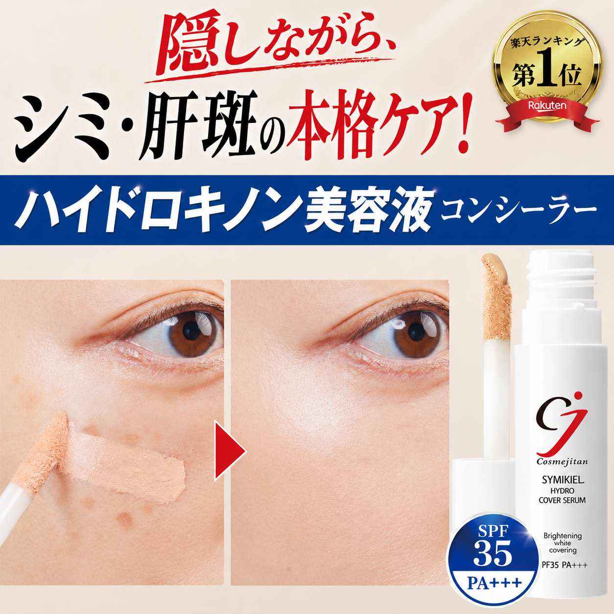 シミ 肝斑 隠し ハイドロキノン コンシーラー シミ消し 浸透型ビタミンC くすみ クマ 隠し カバー SPF32 UV シミ取り シミキールハイドロカバーセラム 爆買