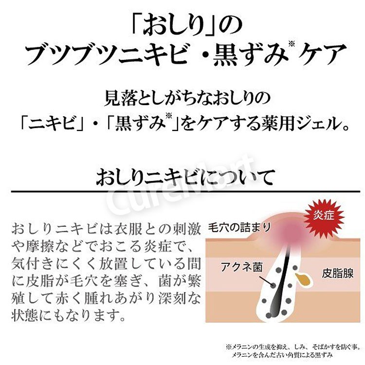 割引クーポン Bro ボディ ケアジェル 医薬部外品 35g 男性用 おしり にきび お尻 ニキビ お尻 黒ずみ ニキビケア ぶつぶつ 薬用ジェル 1048101 キュアマート 通販 Yahoo ショッピング