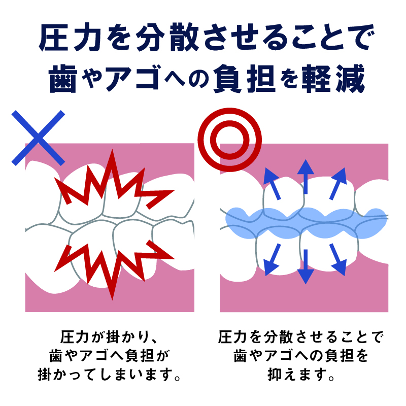 男女兼用 繰り返し使用可能 マウスピース【おとなしくん】歯ぎしり