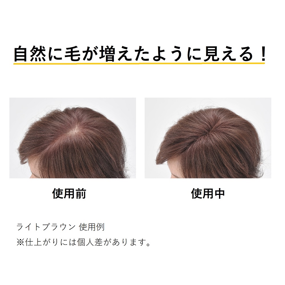 ヘアケア 育毛剤 カラーリング スーパーミリオンヘアーEX 20g 単品