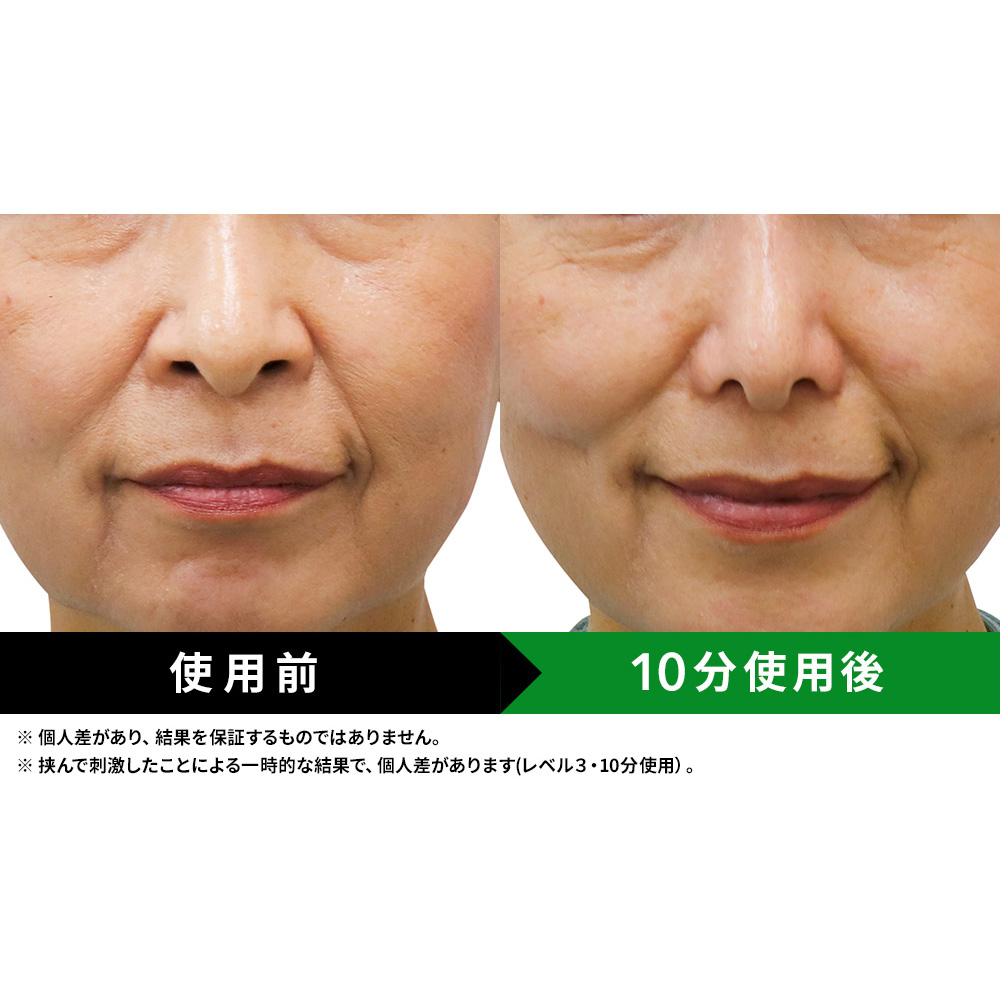 LUXCEAR フェイスケア 美顔器 ルクセアフォーネスPRO（鼻用美顔