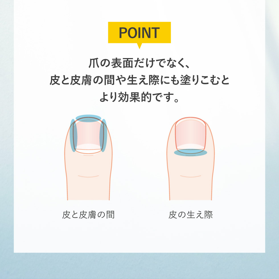 PICOMONTE(ピコモンテ) 薬用 爪ケアジェル 15g 爪周りケア 殺菌 消毒 PICOMONTE(ピコモンテ) 薬用 爪ケアジェル 15g 爪周りケア 殺菌 消毒