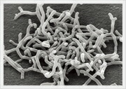 Bifidobacterium longum BB536