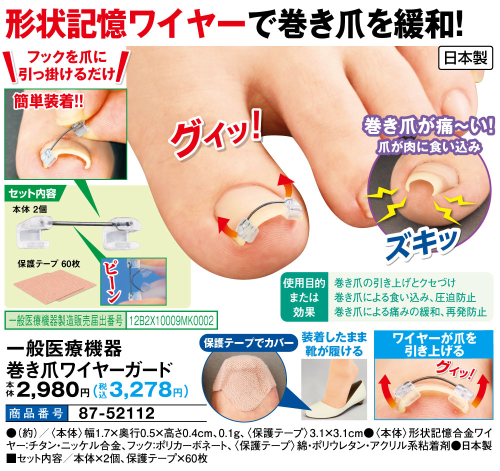一般医療機器巻き爪ワイヤーガード |  | 01