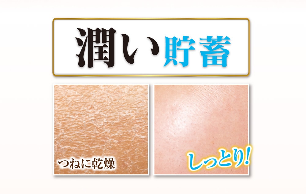 薬用美白リンクルリペアホワイティーローション 150mL  2本組 |  | 02