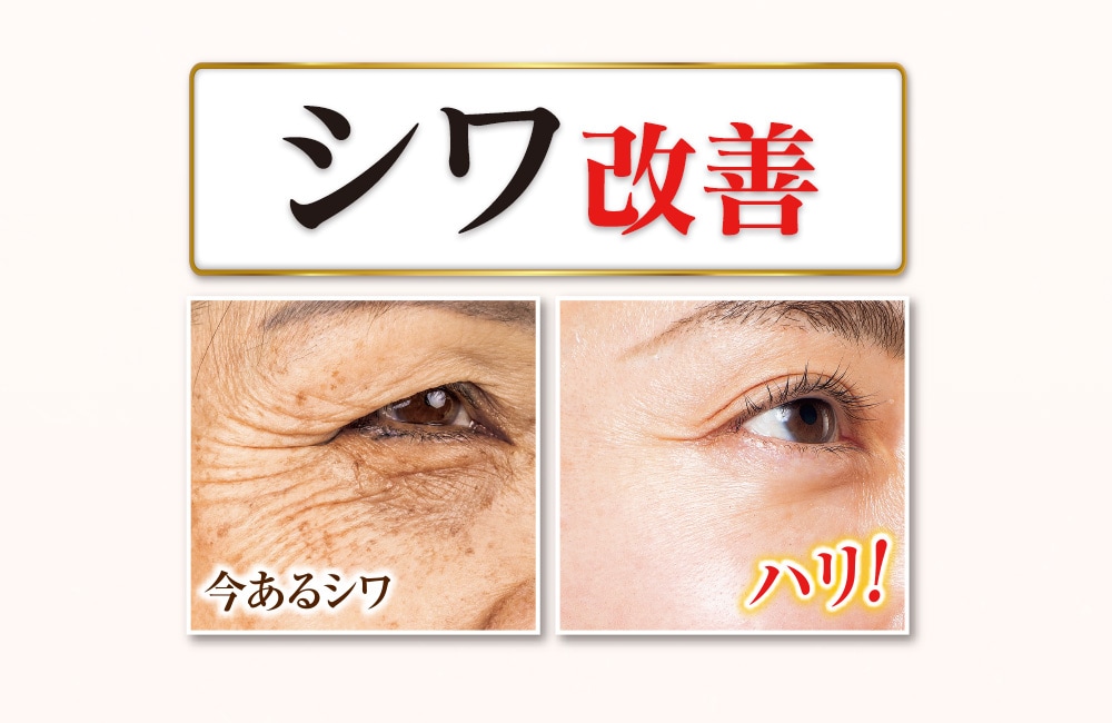 薬用美白リンクルリペアホワイティーローション 150mL  2本組 |  | 03