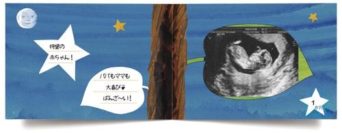 エコー写真アルバム