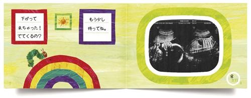 エコー写真アルバム