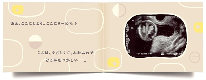 エコー写真アルバム