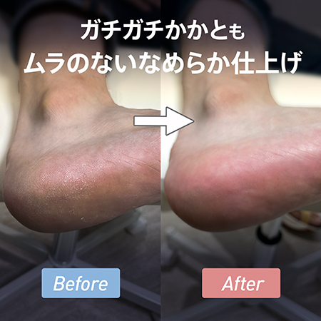 m.Soin コードレスフットグラインダー EMG-FC2 1年保証 角質ケア 足裏