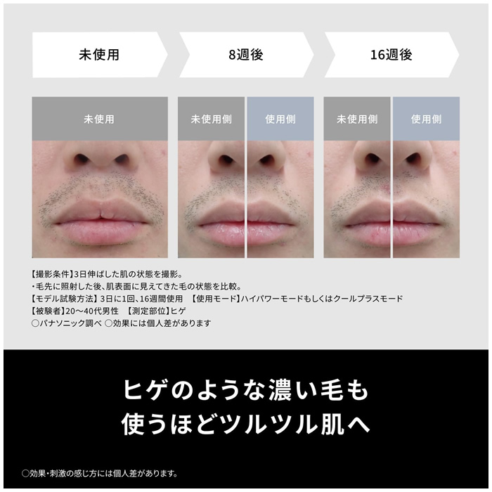 光エステ パナソニック スムースエピ パワー＆クール ES-WG0B-H グレー