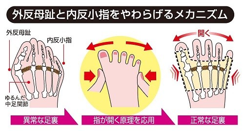 いいもの見つけた！外反母趾・内反小指サポーター