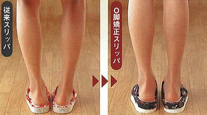 送料無料!O脚矯正スリッパ