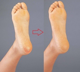 いいもの見つけた！寝ている間にかかとツルツル 新おやすみエステ