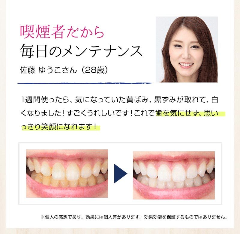 工場直送 ホワイトニング ジェル セルフ 医薬部外品 パールホワイトプロex 全商品オープニング価格特別価格 Iq Toys Com