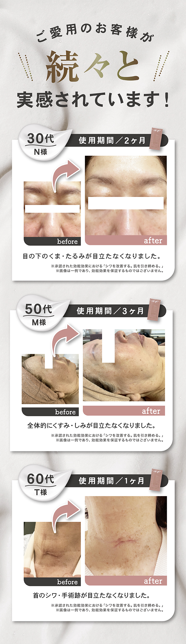 楽天市場】Moi Belle モ ベレ しわ改善 美白 クリーム 医薬部外
