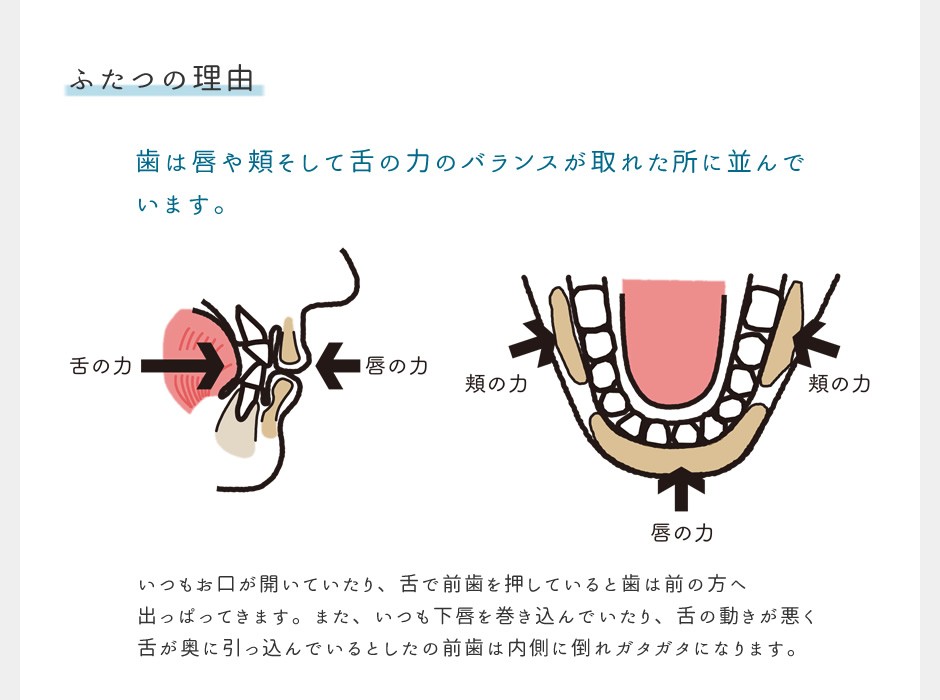 ベビーチェア ハイチェア キッズチェア マッチーズハイチェア マッ