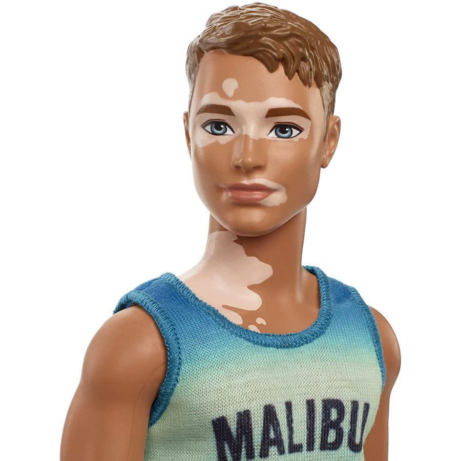 バービー ケン ファッショニスタ マリブ タンクトップ 尋常性白斑 ドール 人形 Barbie Ken Fashionistas Vitiligo  MALIBU Tank