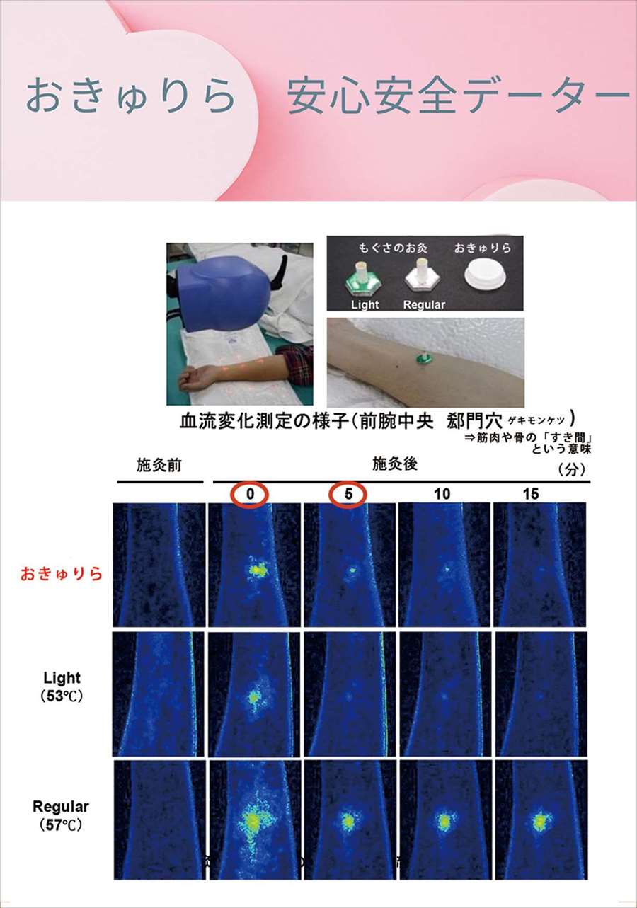 血流変化測定