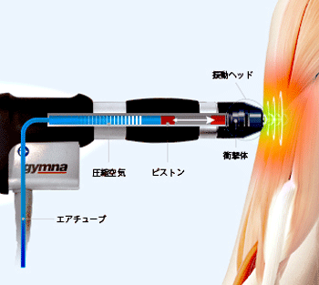 ショックマスター