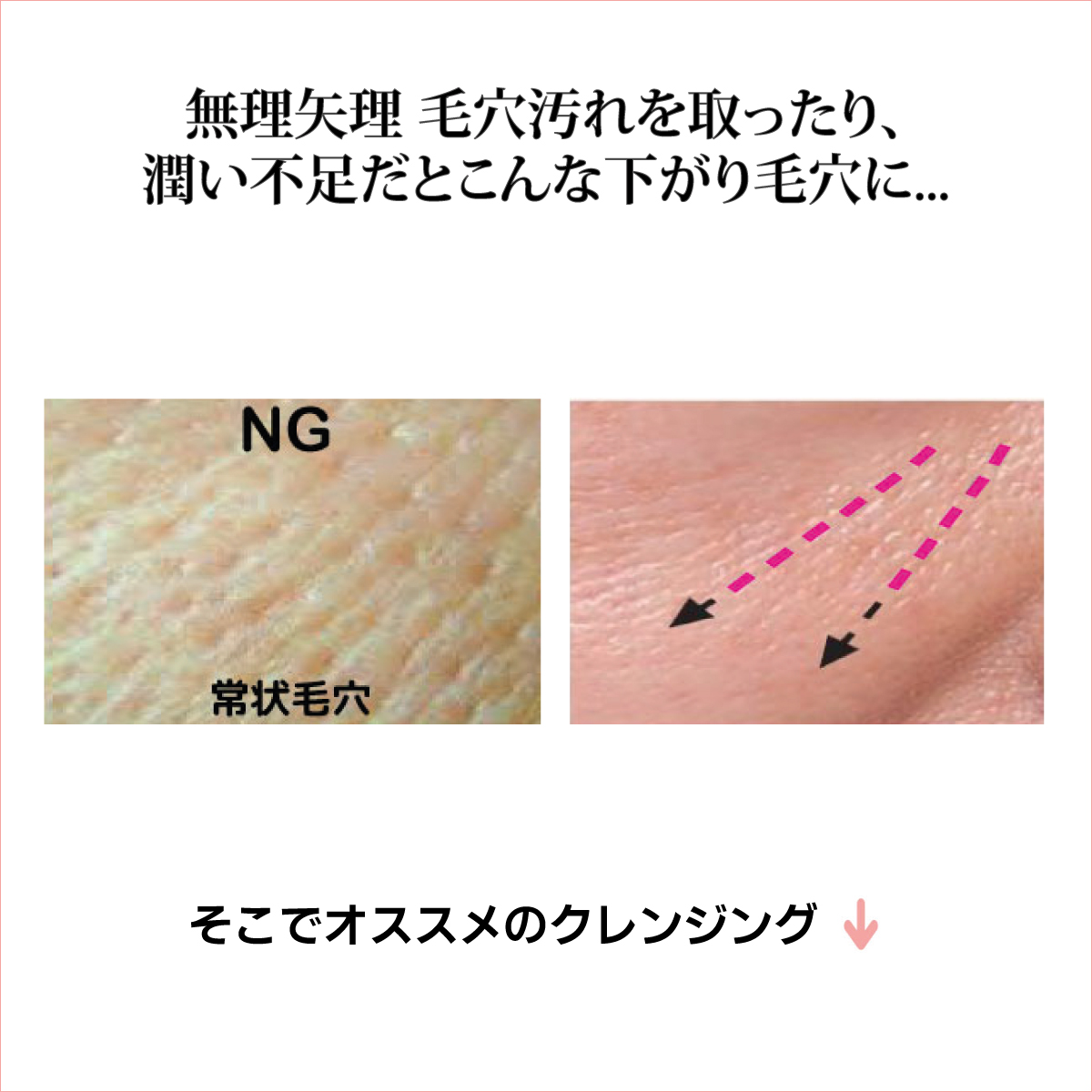 skin_versa
