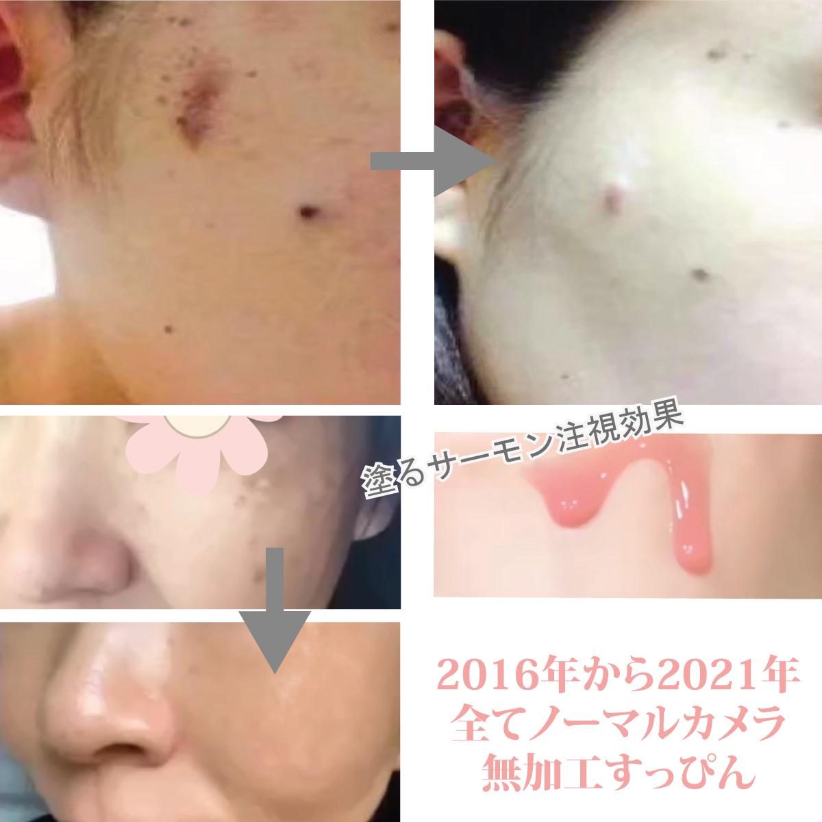 satisfymeBefore&after