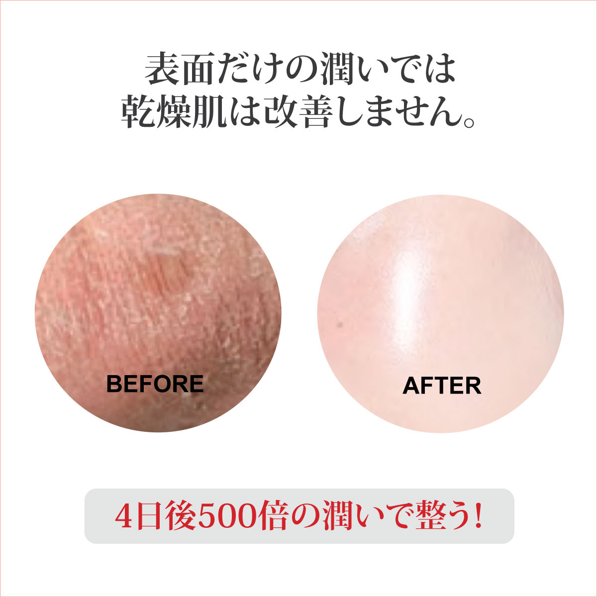 replenishme_before&after