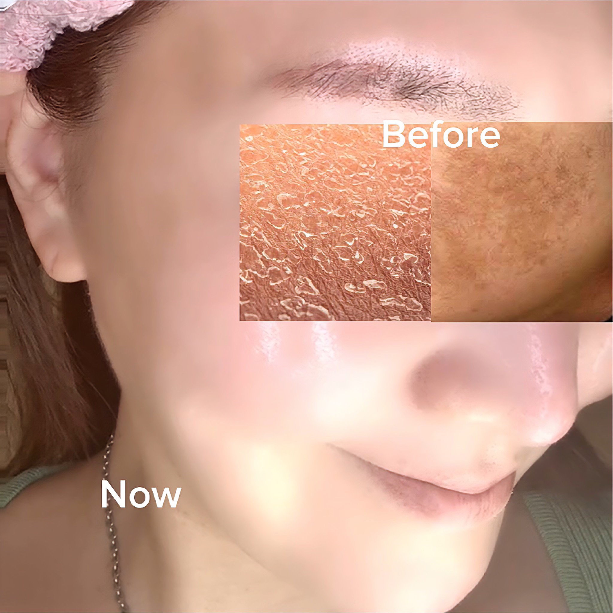 before&after