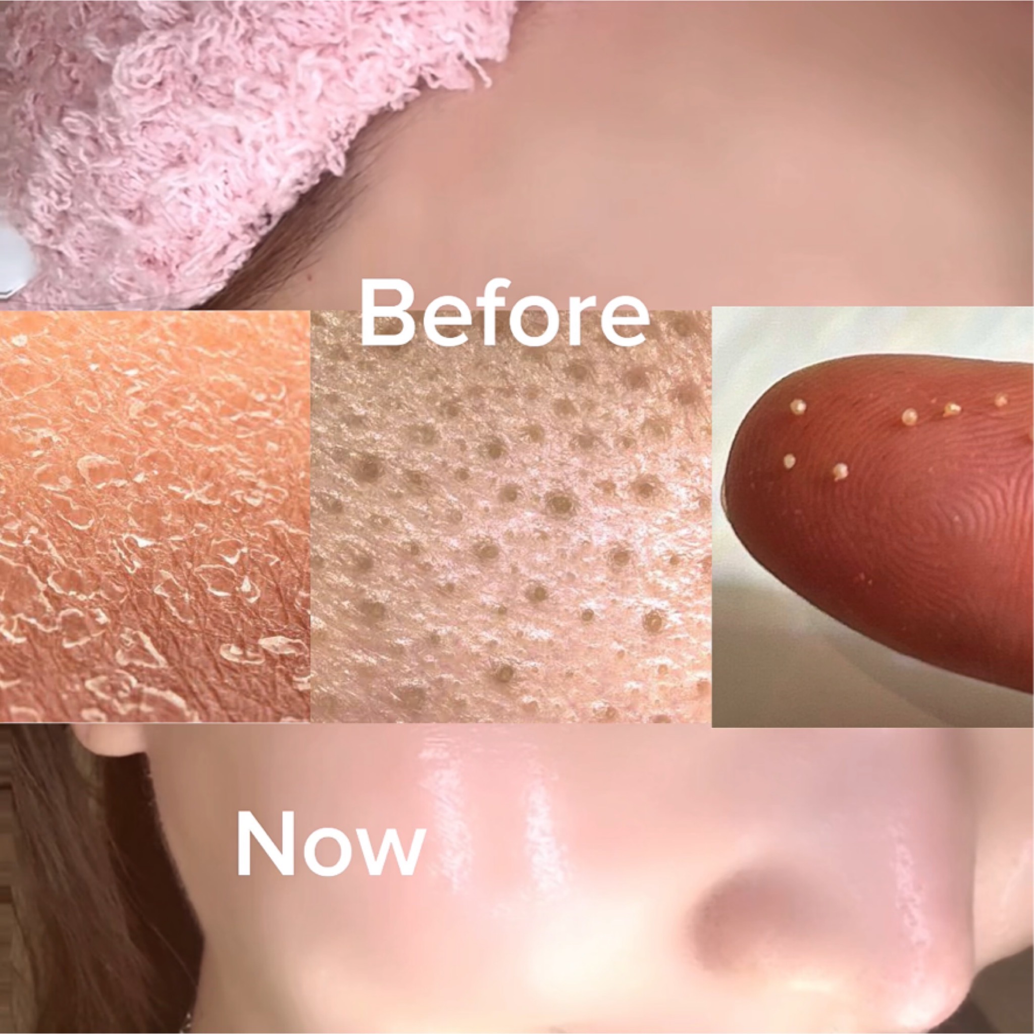 before&after