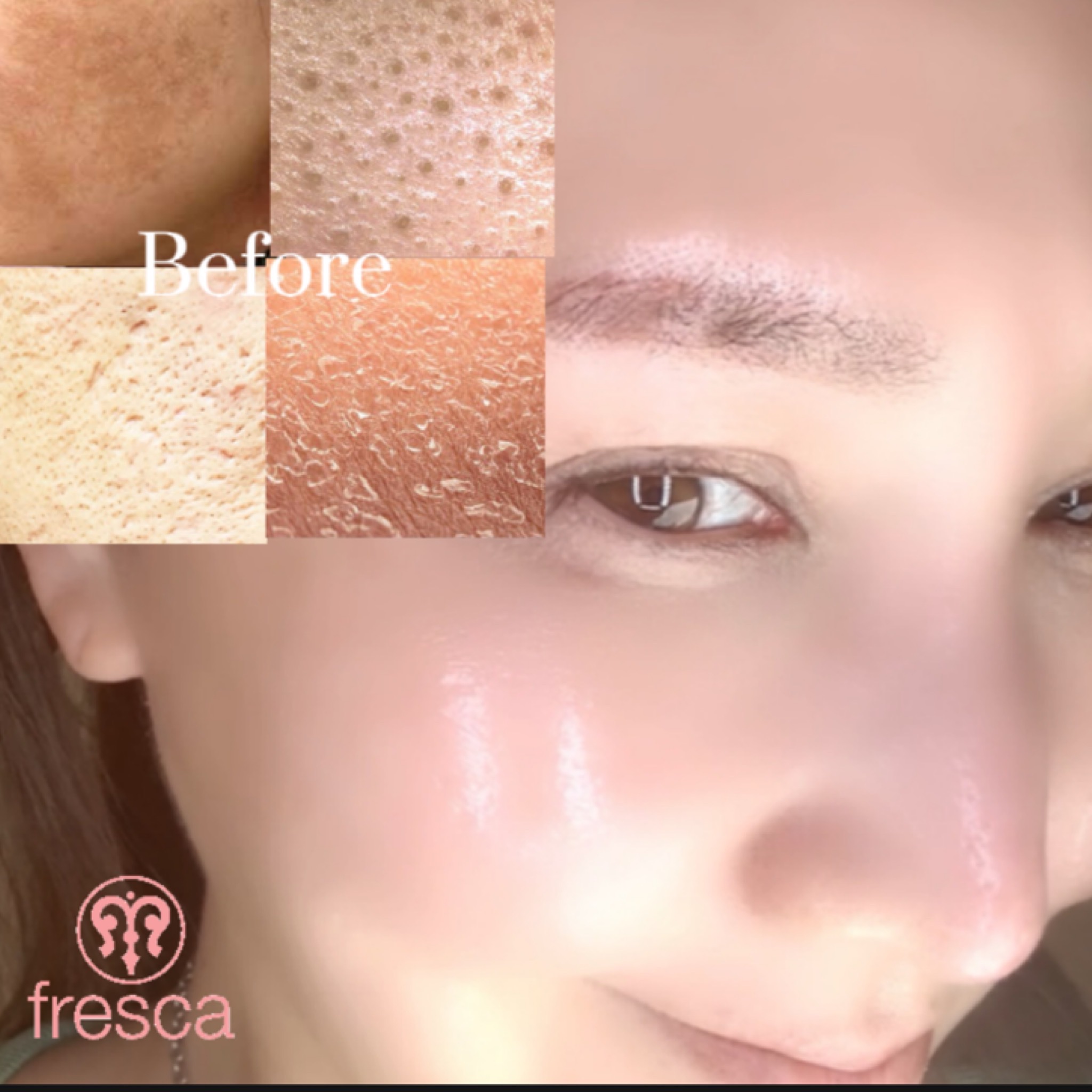 3before&after
