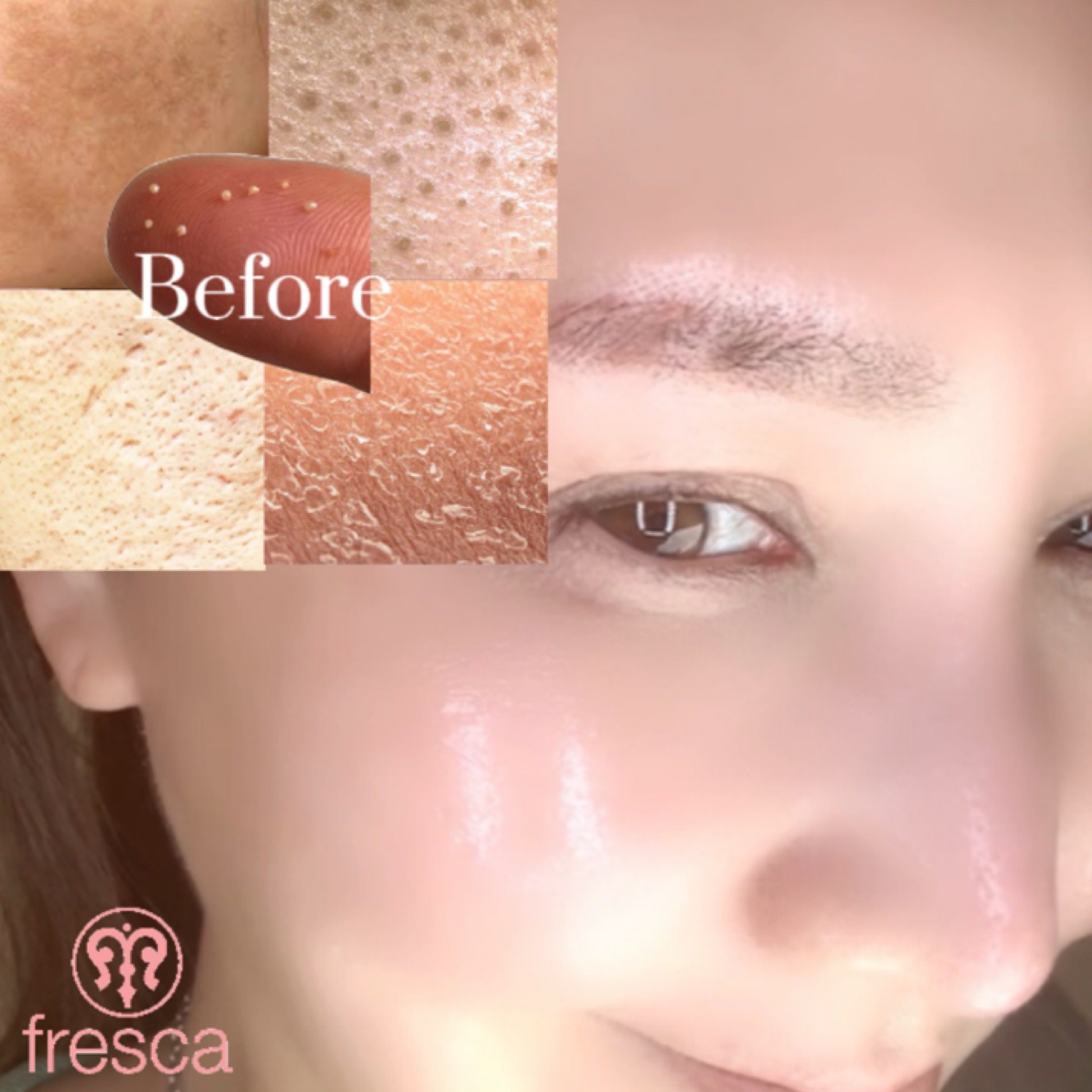3before&after