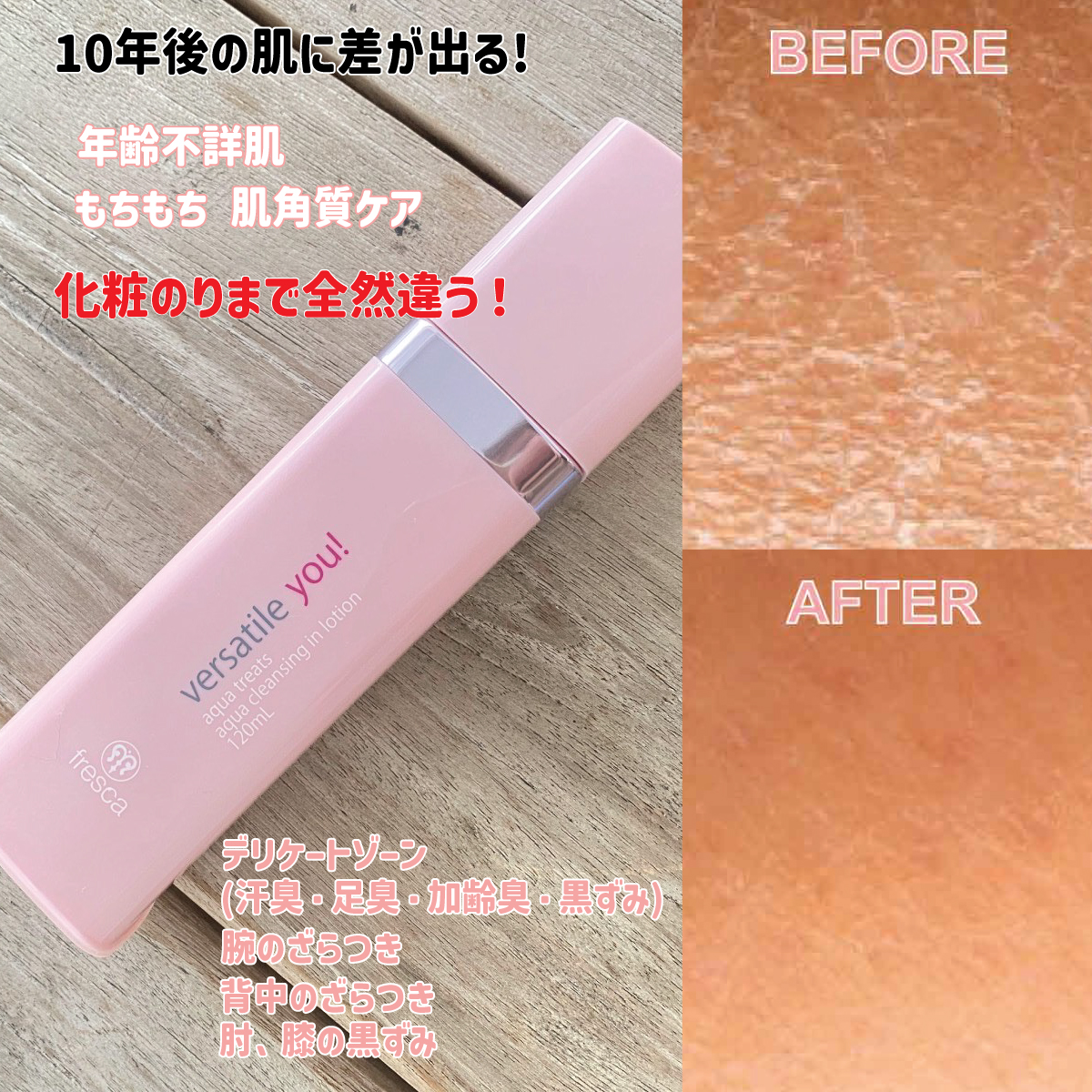 versa_before&after