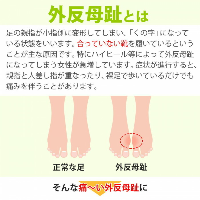 痛い外反母趾に