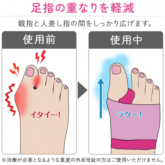 足指の重なりを軽減