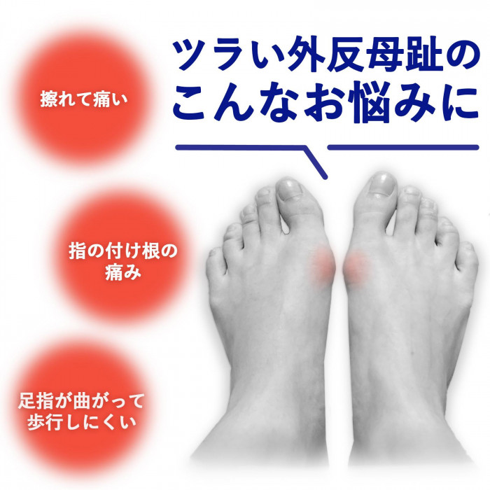 つらい外反母趾のお悩みに