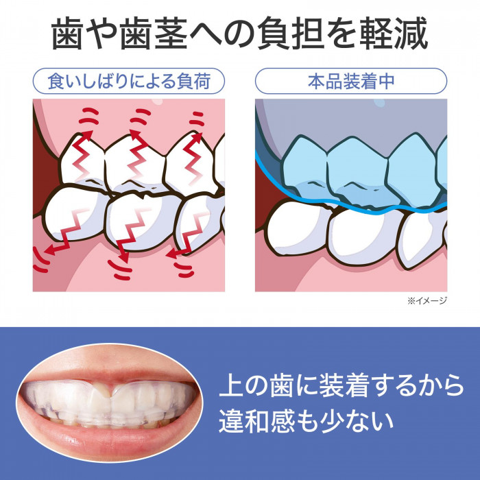 食いしばりによる歯や歯茎への負担を軽減