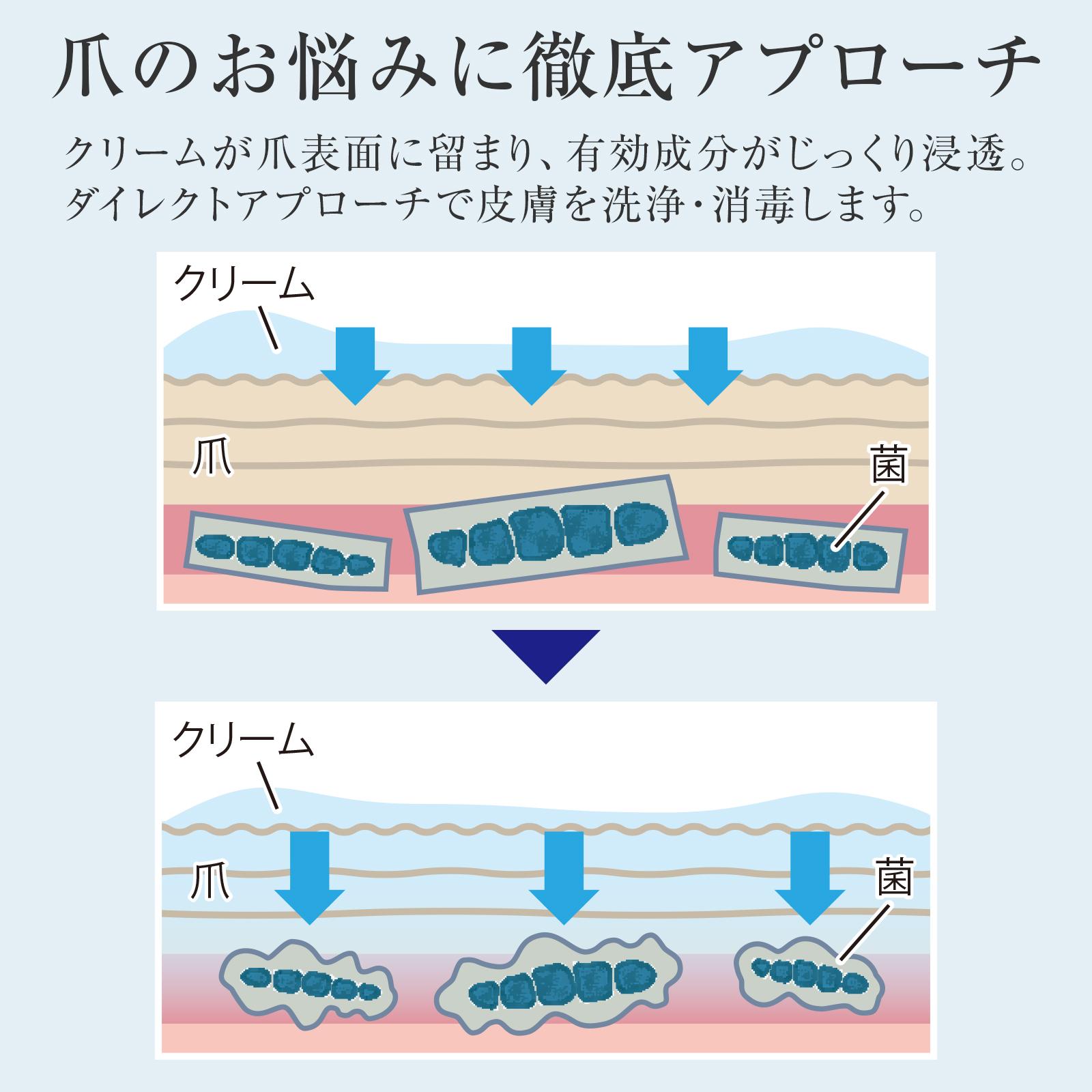爪のお悩みに徹底アプローチ
