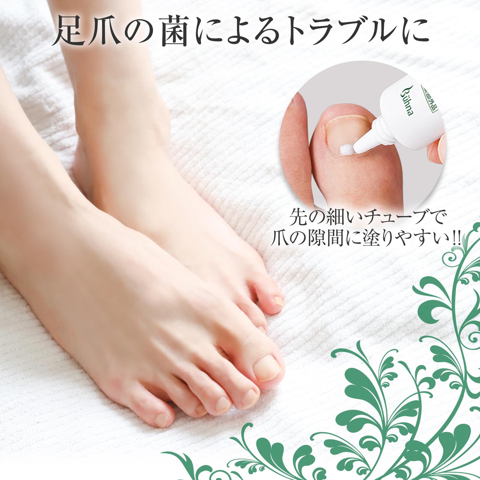 ビューナ 薬用足爪きれいα 指定医薬部外品 クリーム チューブ 爪