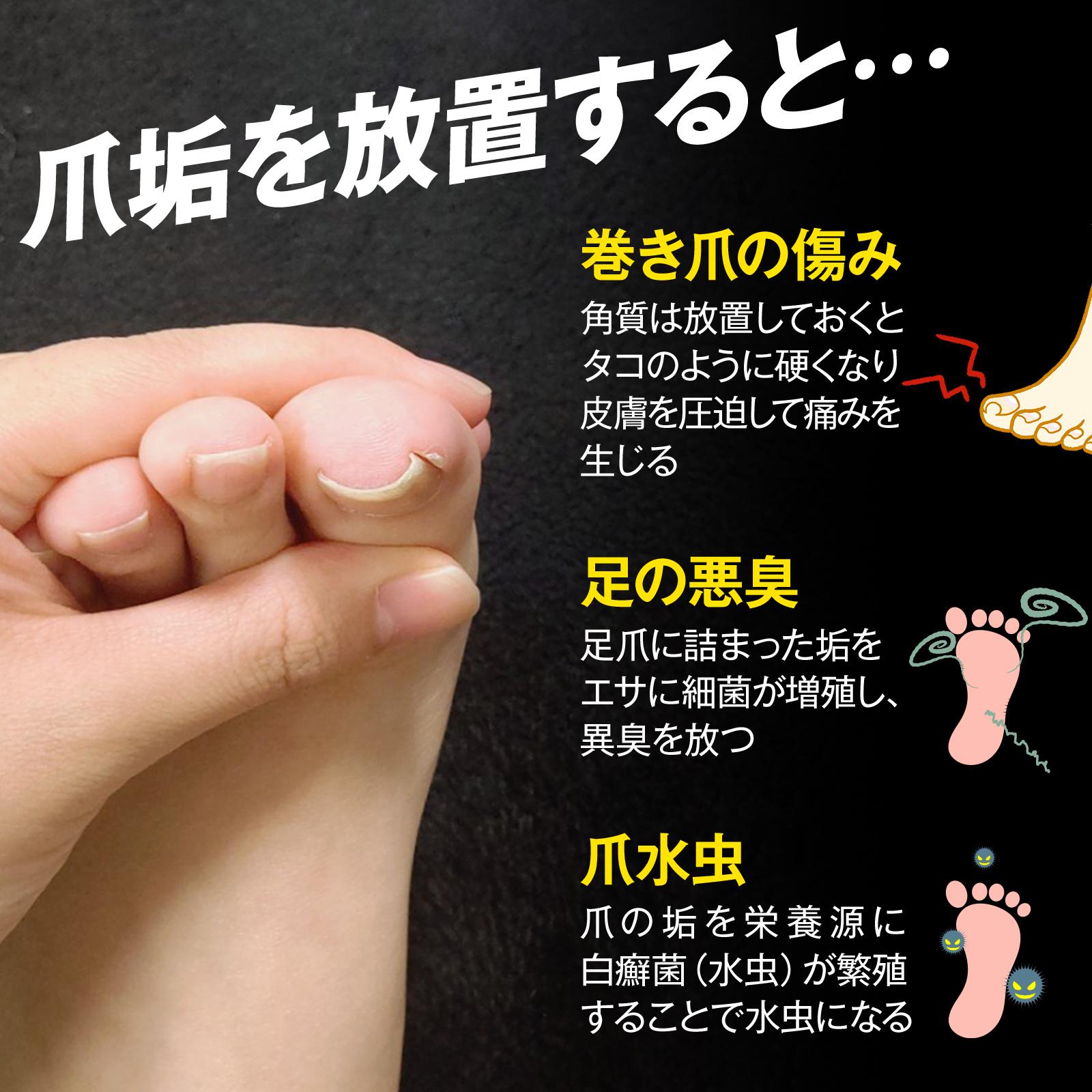 爪垢を放置すると…
