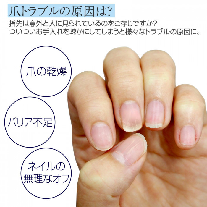 爪トラブルの原因