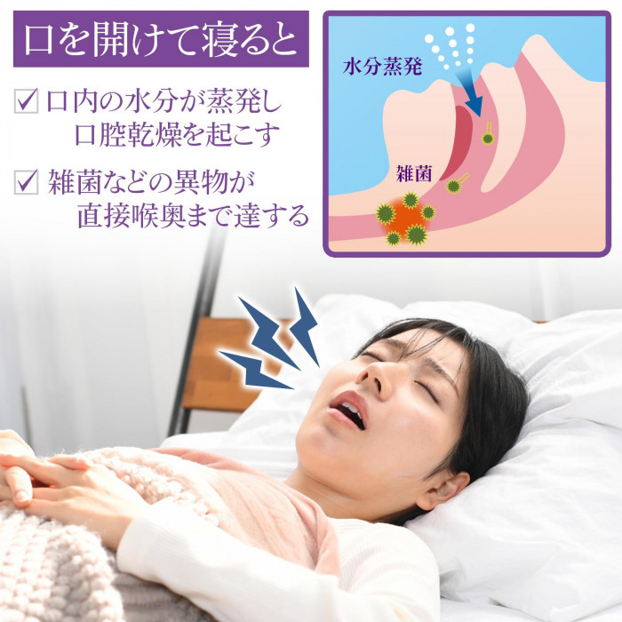 口を開けて寝るとさまざまなトラブルが…