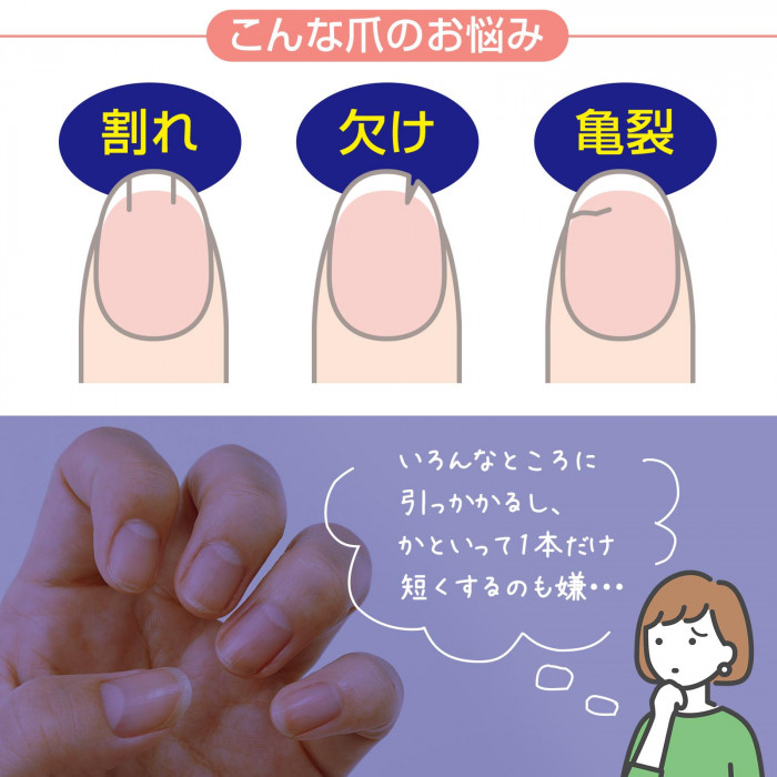 割れ・欠け・亀裂など爪のトラブルに