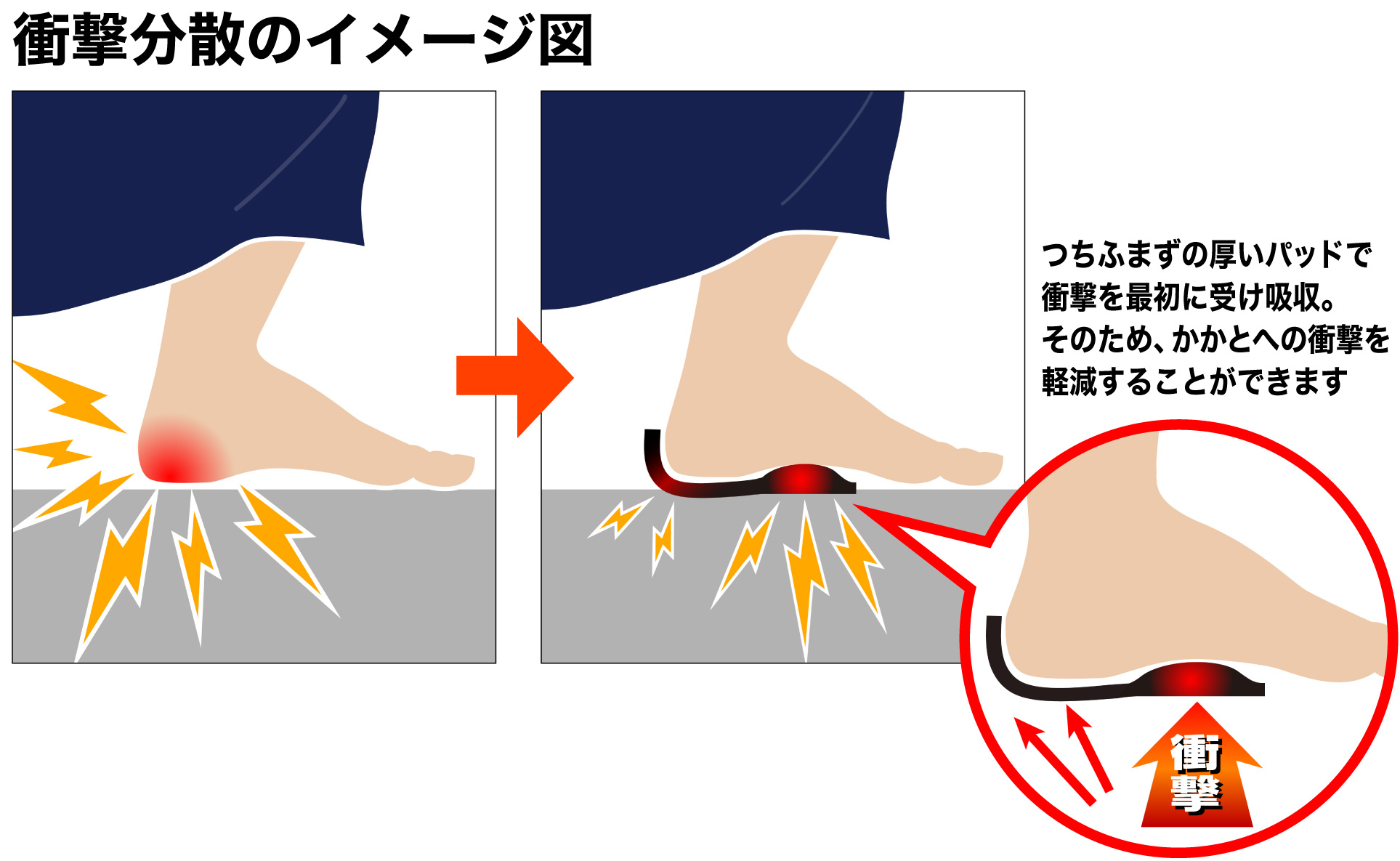 足底サポーターの衝撃二段吸収パッド　説明