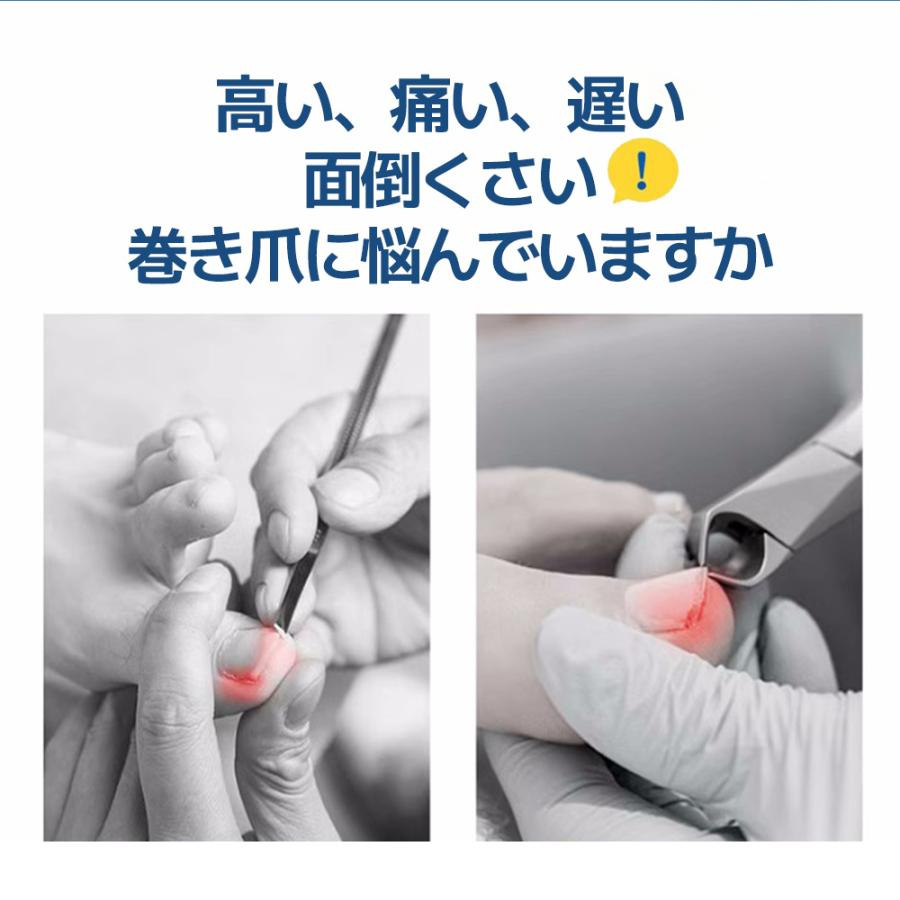 2個セット 巻き爪 矯正 器具 マキちゃんセット 自分で治す方法