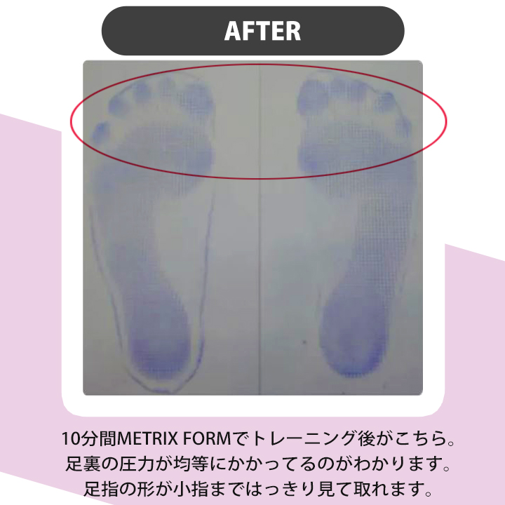 メトリクスフォーム　2枚セット 送料無料】 ボディメトリクス メトリクスフォーム (ミニ